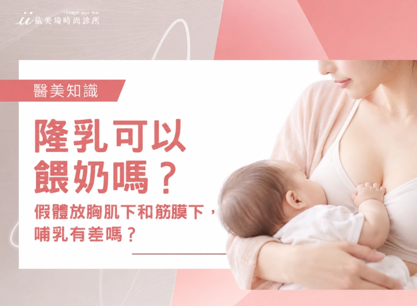 隆乳可以餵奶嗎？假體放胸肌下和筋膜下，哺乳有差嗎？