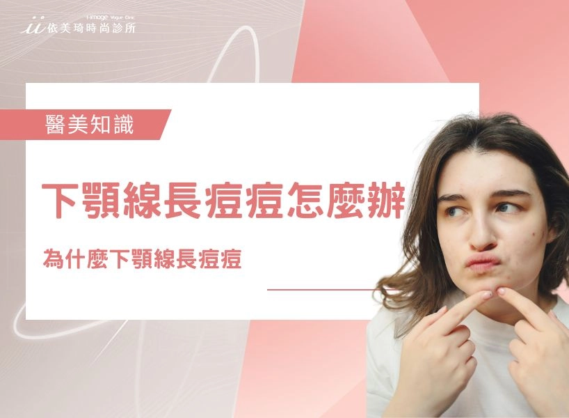 【下顎線長痘痘】下顎線長痘痘怎麼辦？為什麼下顎線長痘痘？