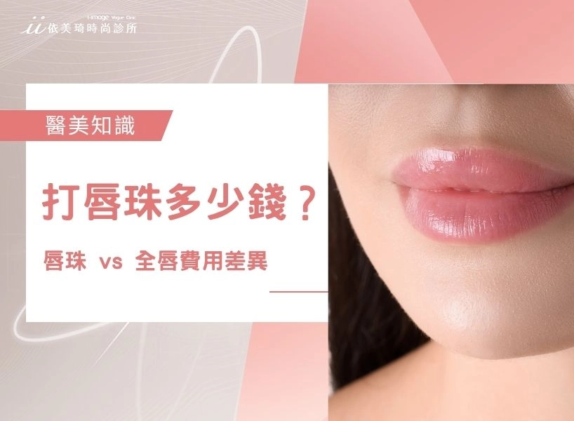 打唇珠多少錢？唇珠 vs 全唇費用差異、影響價格的關鍵因素一次說清楚