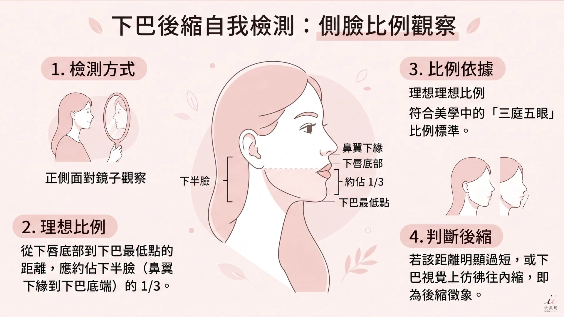 正側面對鏡子，從下唇底部到下巴最低點的距離，理想上約佔下半臉的 1 / 3（ 三庭五眼比例 ） 。 若這段距離明顯過短、下巴彷彿縮進去，即為後縮的徵象。
