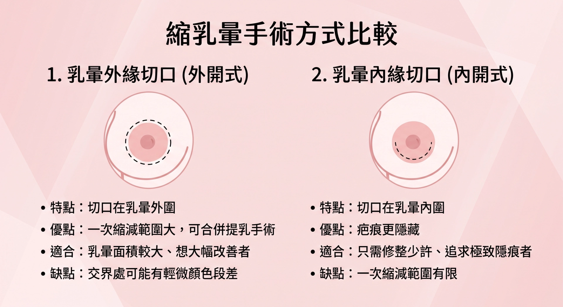 「 縮乳暈手術 」 改善。 手術原理是沿著乳暈與周圍皮膚的顏色分界線，做一圈環形 （ 甜甜圈狀 ） 切口，切除多餘的乳暈皮膚後再細緻縫合，讓乳暈直徑縮小、與胸部比例更協調。 由於切口就藏在乳暈與皮膚顏色本來就有落差的交界處，疤痕相對容易融入、較不明顯。