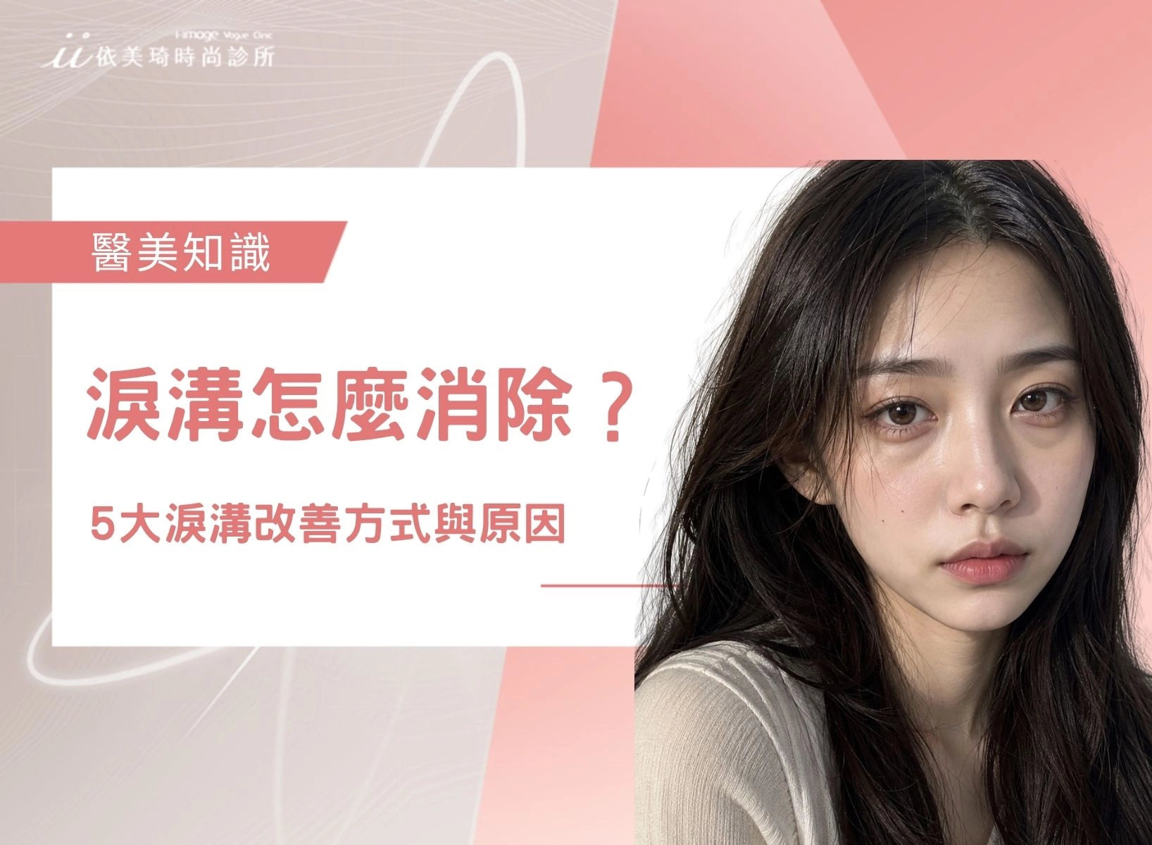 【2026最新】淚溝怎麼消除?五大淚溝改善方式與淚溝凹陷原因