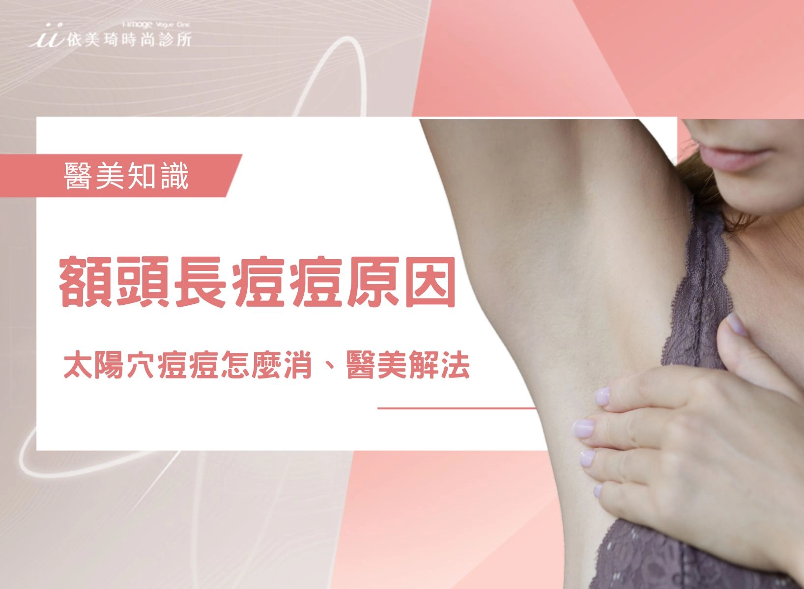 狐臭原因是什麼？狐臭味道、自我判斷與螺旋刀手術一次看
