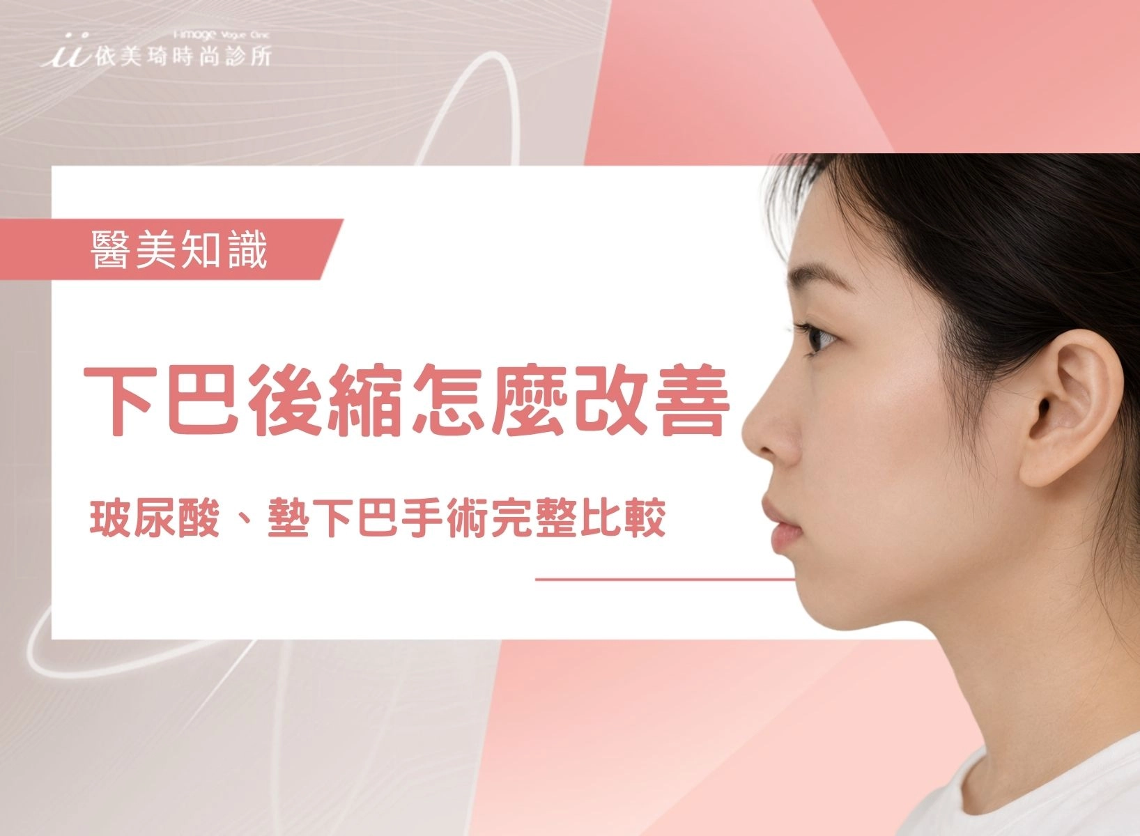 下巴後縮怎麼改善？【2026最新】玻尿酸、墊下巴手術完整比較｜依美琦時尚診所