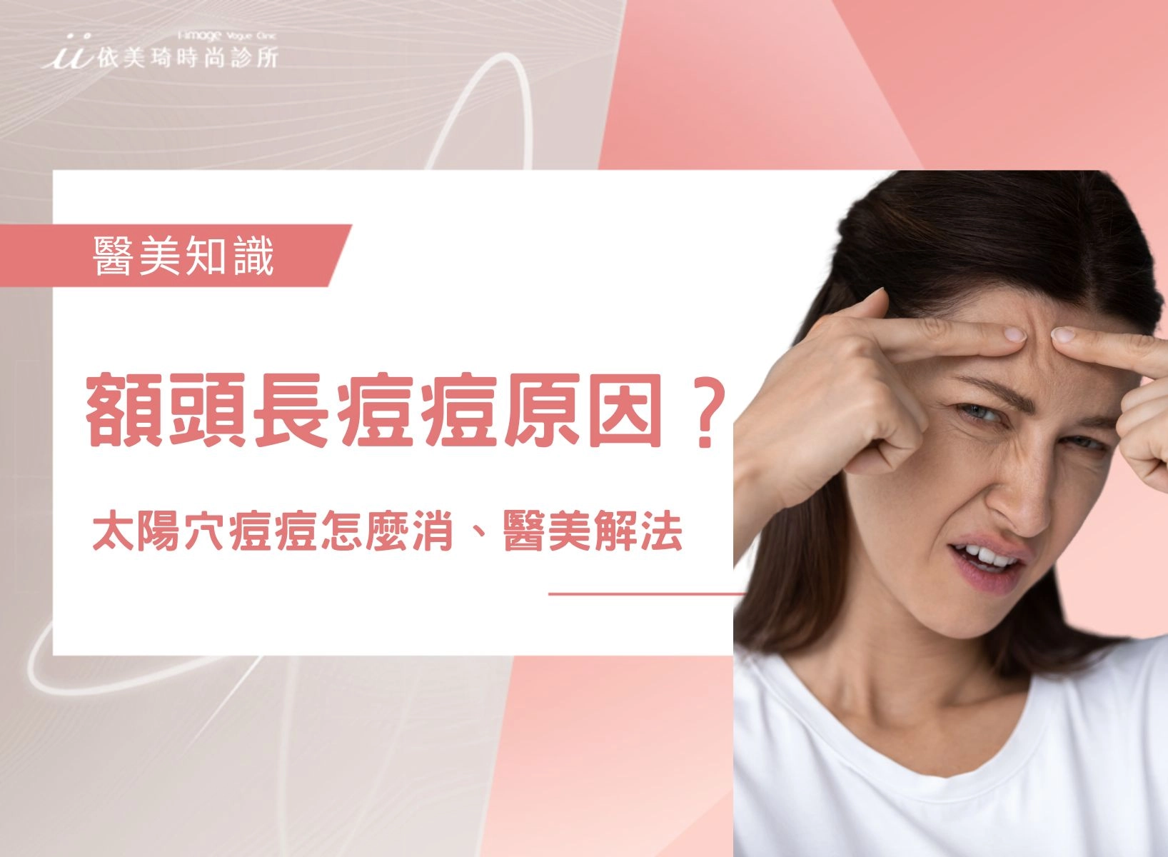 額頭長痘痘什麼原因?太陽穴痘痘、怎麼消與醫美痘疤解法一次看!