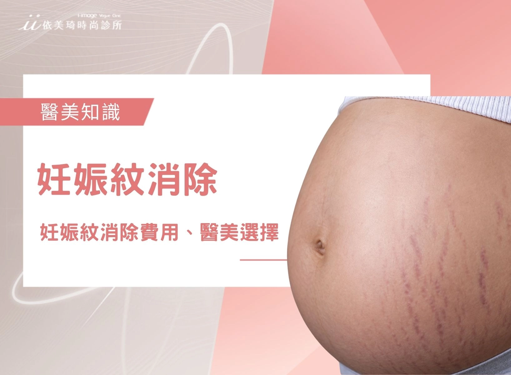 妊娠紋有辦法消除嗎？妊娠紋消除費用、妊娠紋醫美選擇一次看！