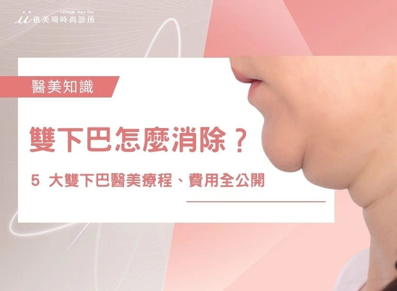 【2026】雙下巴怎麼消除？5 大雙下巴醫美療程、5 種類型自我檢測、費用全公開