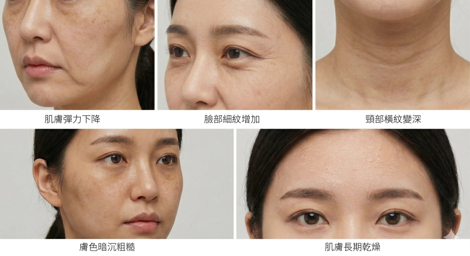 誰適合打彈力針