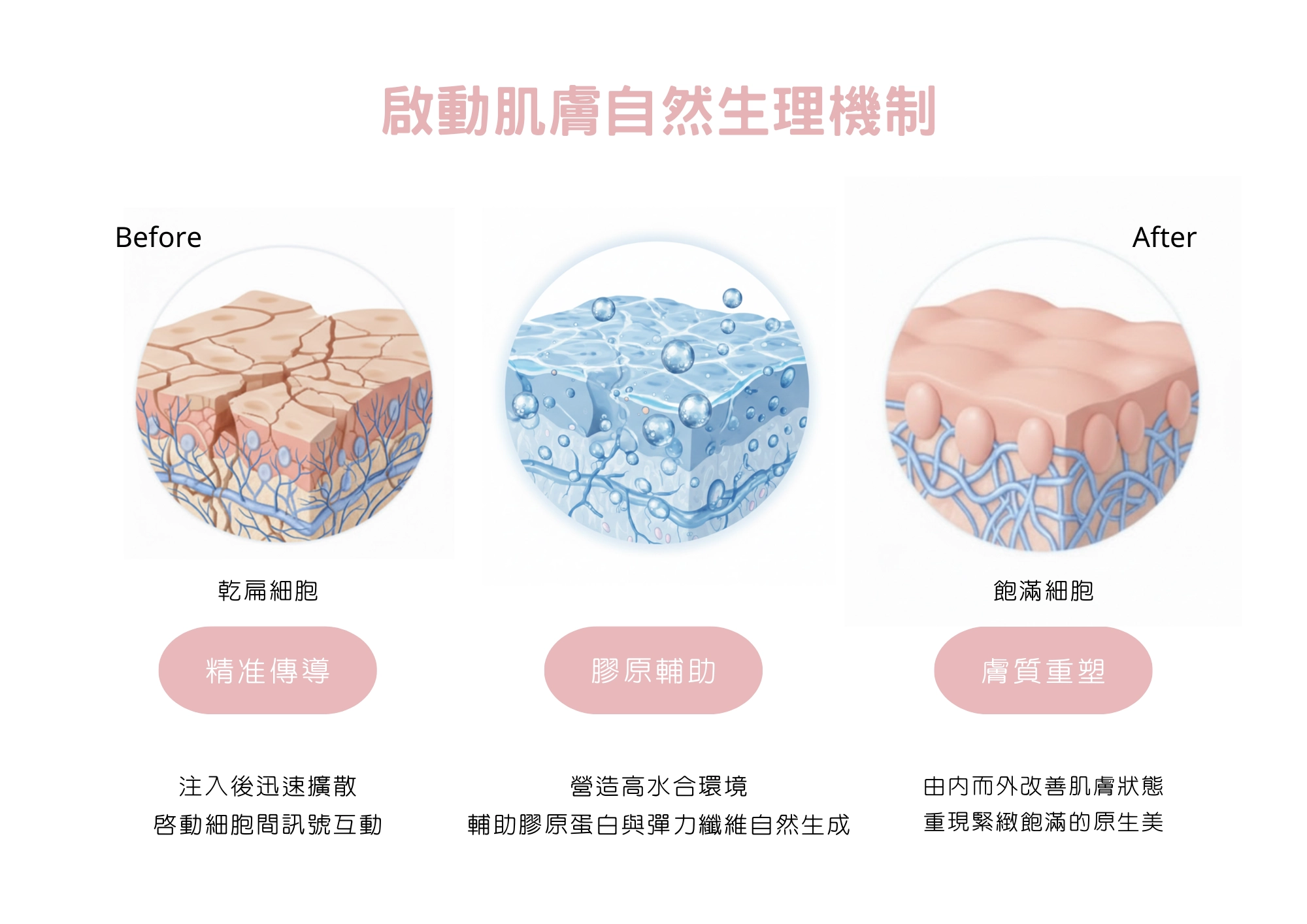 彈力針作用原理